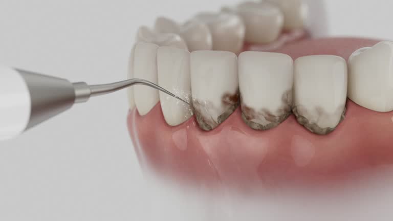 Trusted Root Canal Treatment service in Martinsburg, WV - Dentist Open Now